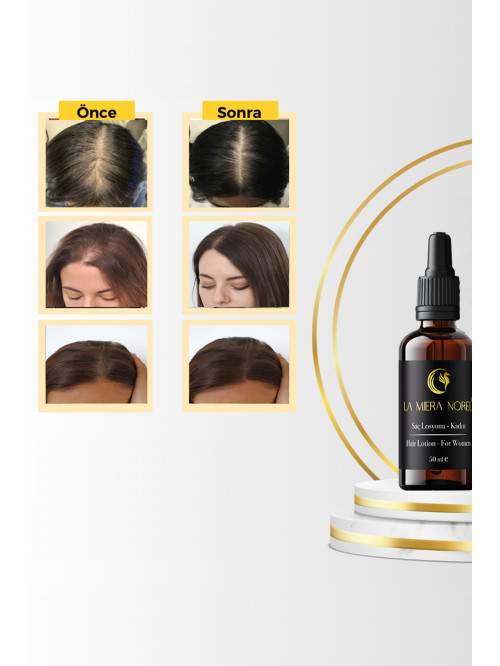 Women's Hair Remover Serum – Prevents Hair Loss, Stre...
